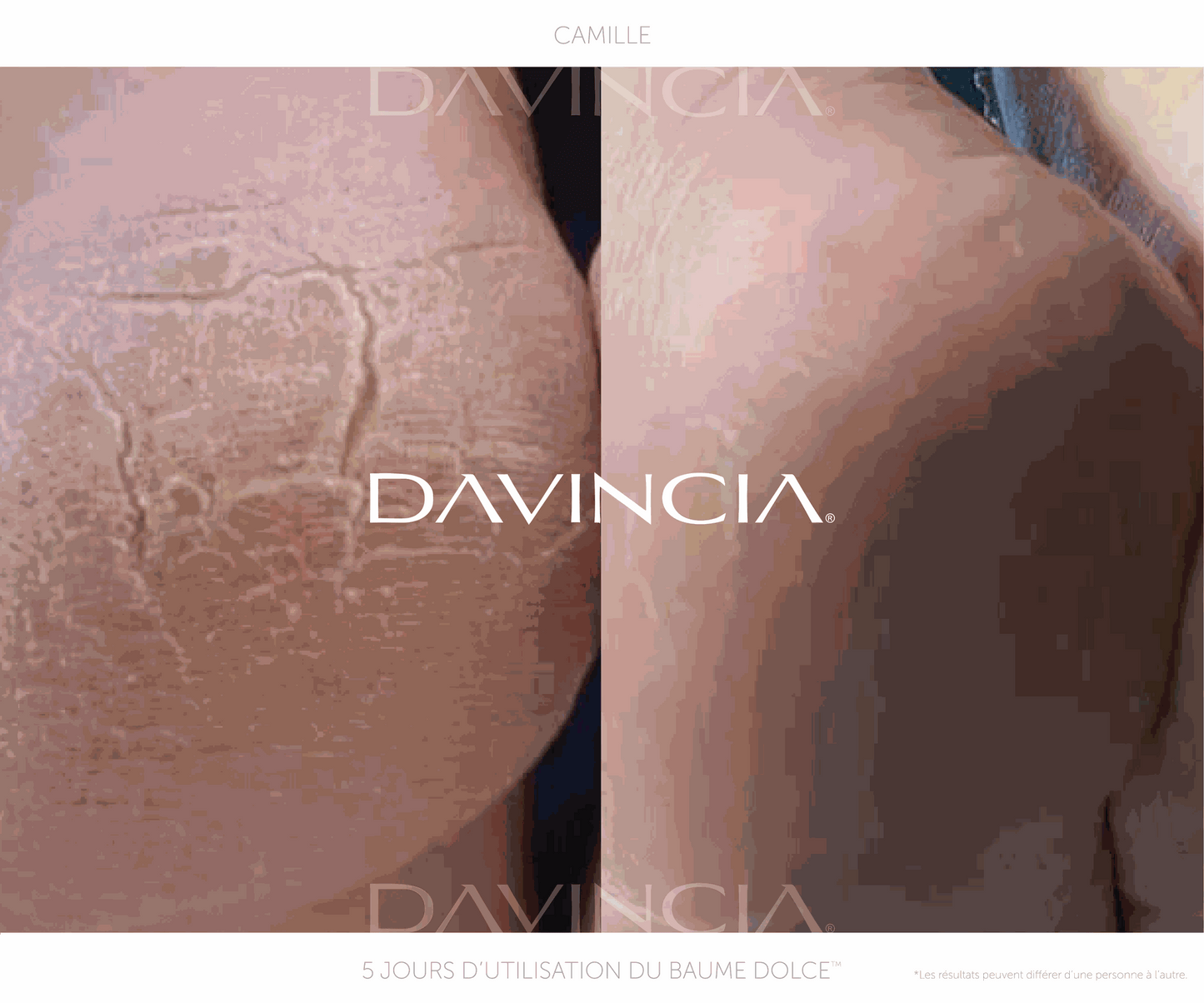 DOLCE™ · Baume réparateur mains et pieds