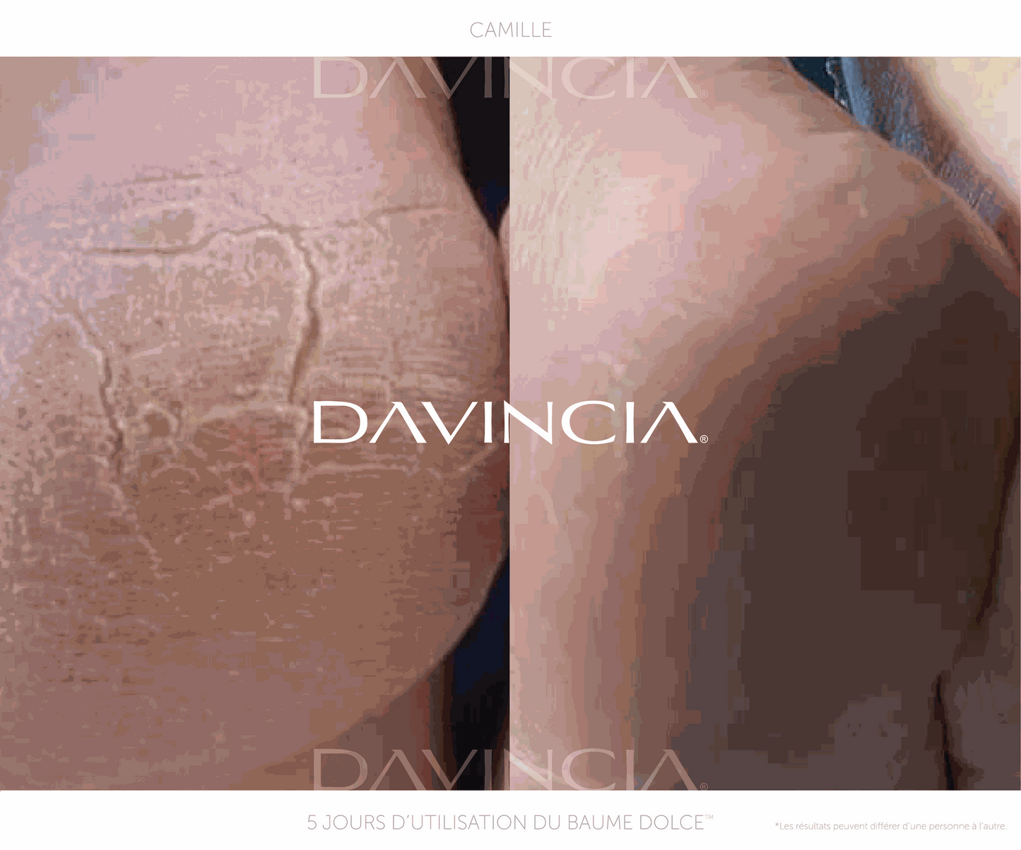 DOLCE™ · Baume réparateur mains et pieds - Harmonie Institut